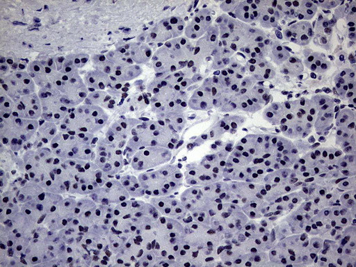 ZNF34 Antibody in Immunohistochemistry (Paraffin) (IHC (P))