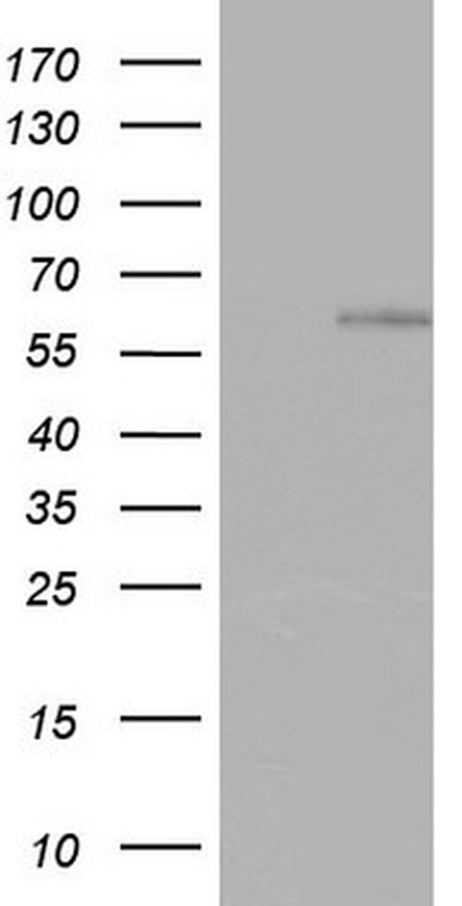 ZNF34 Antibody in Western Blot (WB)