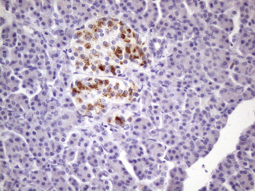 ZNF35 Antibody in Immunohistochemistry (Paraffin) (IHC (P))