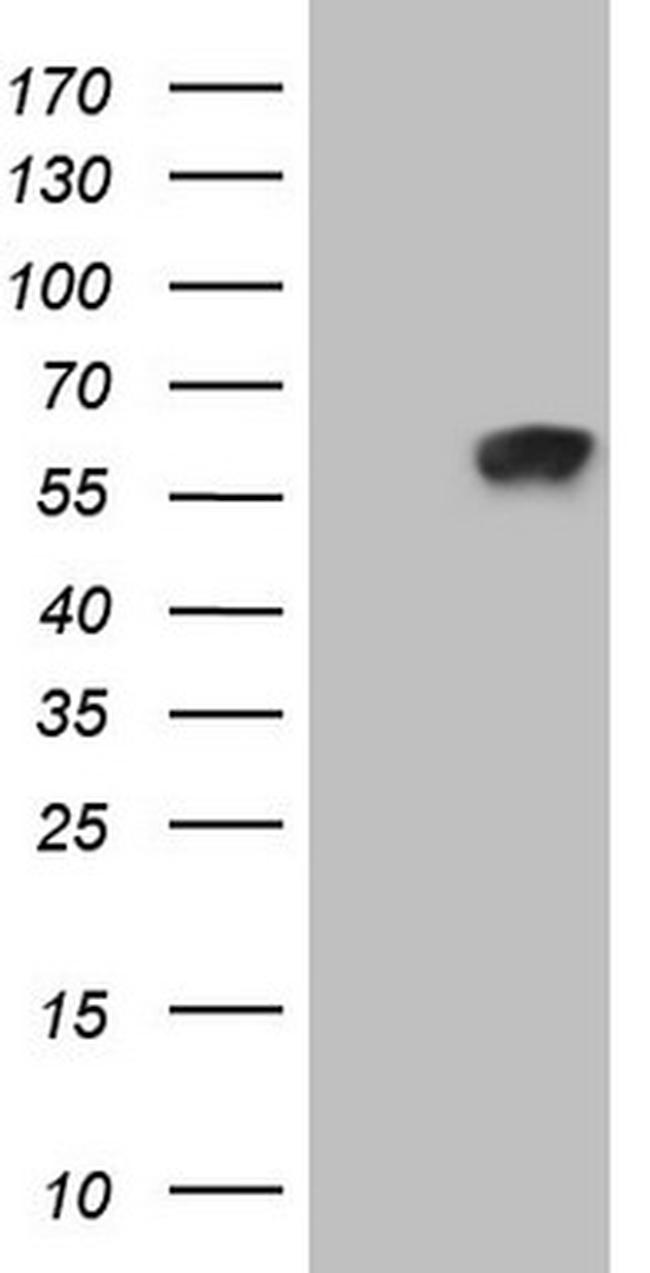 ZNF35 Antibody in Western Blot (WB)