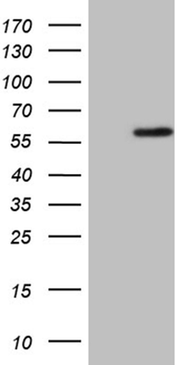 ZNF35 Antibody in Western Blot (WB)