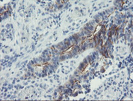 ZNF365 Antibody in Immunohistochemistry (Paraffin) (IHC (P))