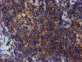 ZNF365 Antibody in Immunohistochemistry (Paraffin) (IHC (P))