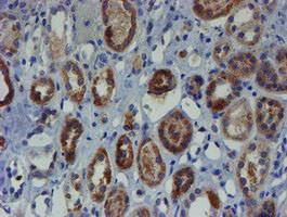 ZNF365 Antibody in Immunohistochemistry (Paraffin) (IHC (P))