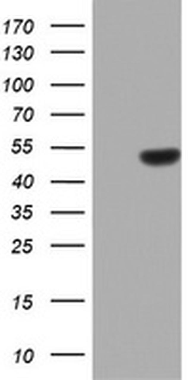 ZNF385B Antibody in Western Blot (WB)