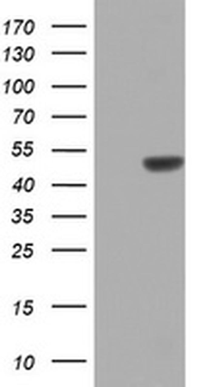 ZNF385B Antibody in Western Blot (WB)