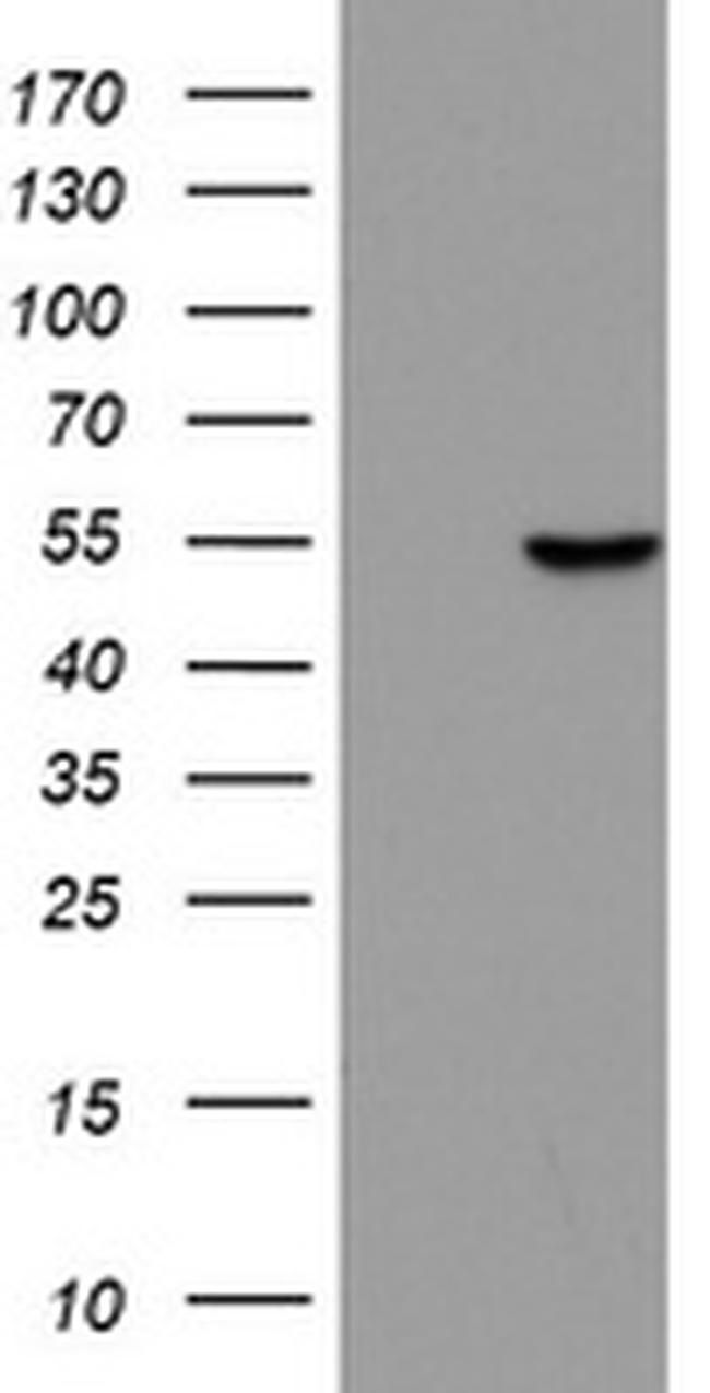 ZNF385B Antibody in Western Blot (WB)