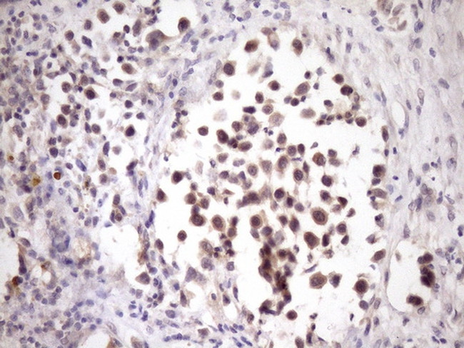 ZNF449 Antibody in Immunohistochemistry (Paraffin) (IHC (P))