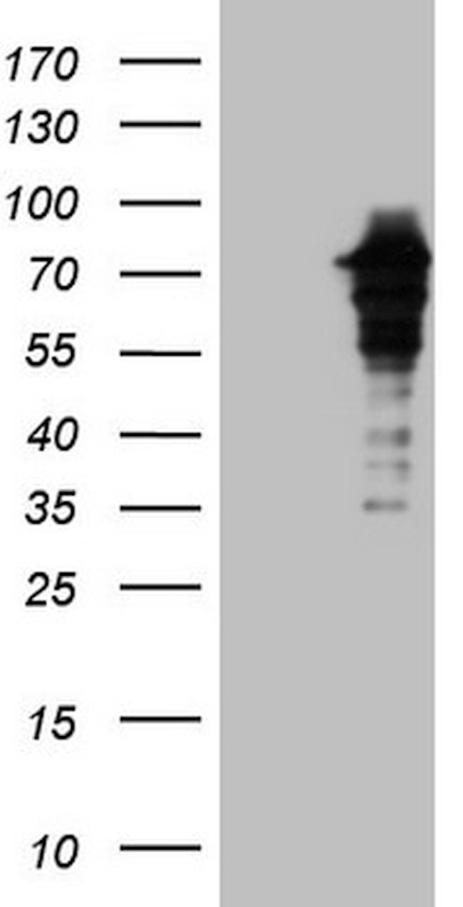 ZNF449 Antibody in Western Blot (WB)