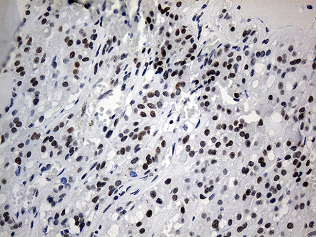 ZNF454 Antibody in Immunohistochemistry (Paraffin) (IHC (P))