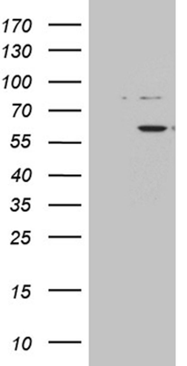 ZNF454 Antibody in Western Blot (WB)