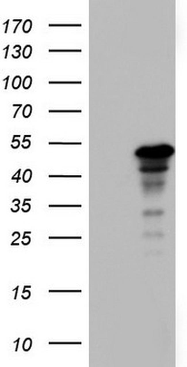 ZNF500 Antibody in Western Blot (WB)