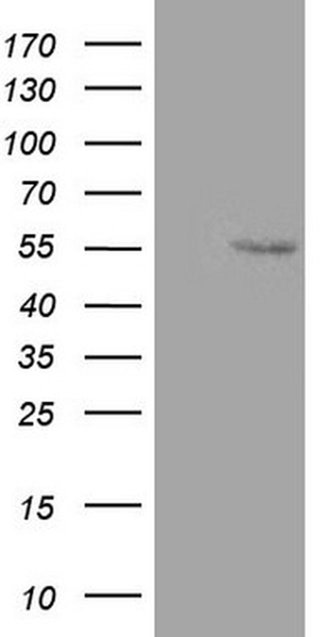 ZNF500 Antibody in Western Blot (WB)