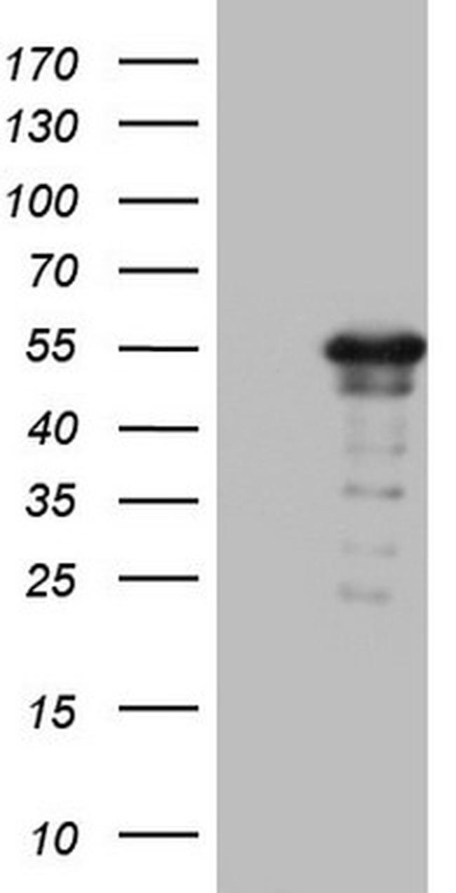 ZNF500 Antibody in Western Blot (WB)