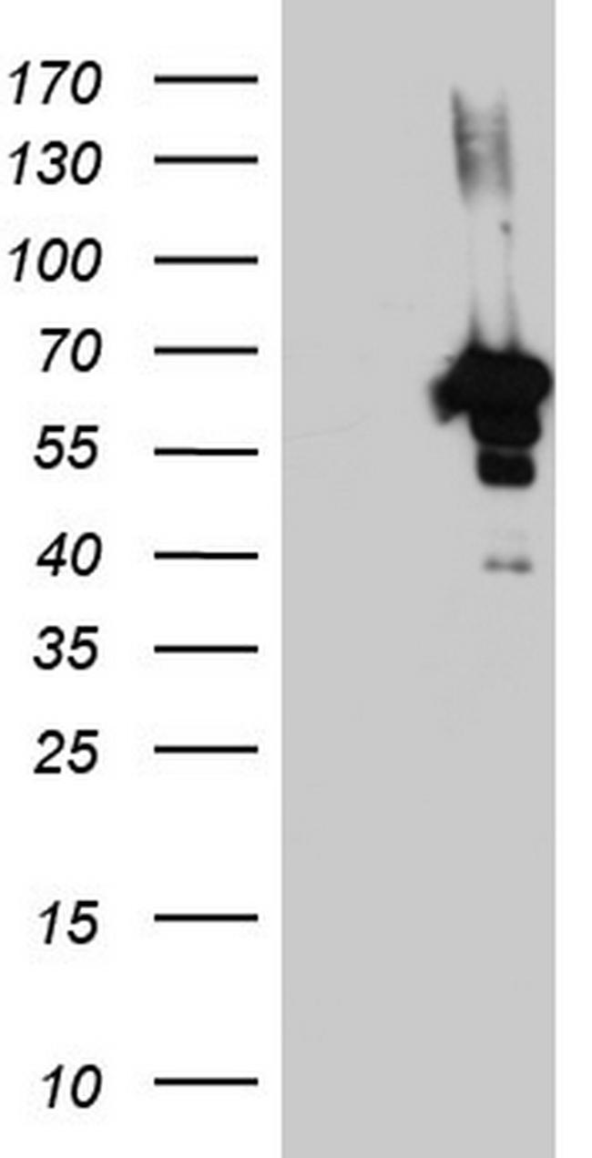 ZNF500 Antibody in Western Blot (WB)