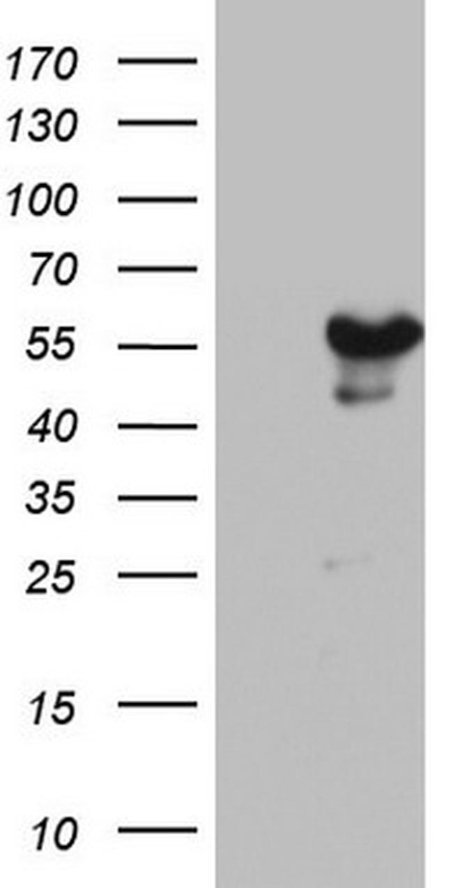 ZNF500 Antibody in Western Blot (WB)