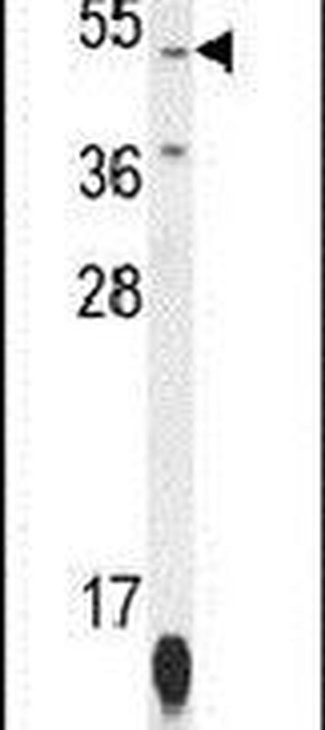 ZNF566 Antibody in Western Blot (WB)