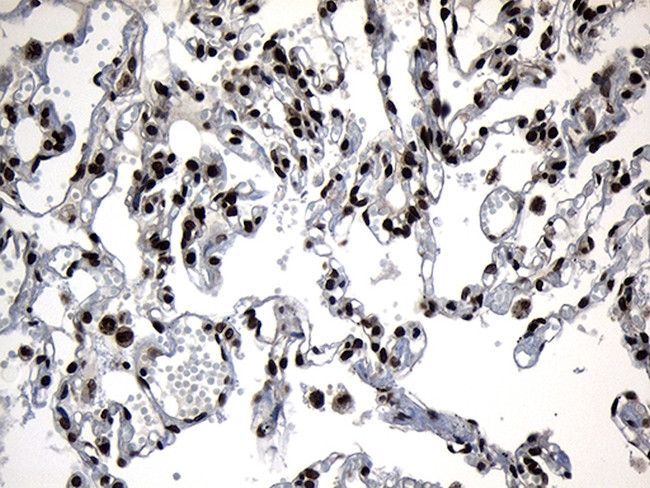 ZNF583 Antibody in Immunohistochemistry (Paraffin) (IHC (P))