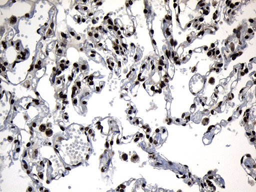 ZNF583 Antibody in Immunohistochemistry (Paraffin) (IHC (P))