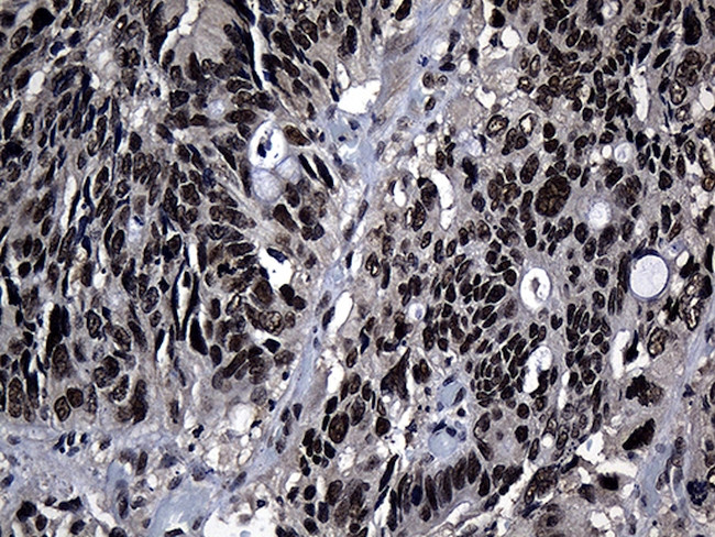ZNF583 Antibody in Immunohistochemistry (Paraffin) (IHC (P))