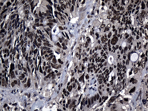 ZNF583 Antibody in Immunohistochemistry (Paraffin) (IHC (P))