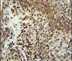 ZNF667 Antibody in Immunohistochemistry (IHC)