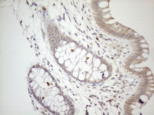 ZNF69 Antibody in Immunohistochemistry (Paraffin) (IHC (P))