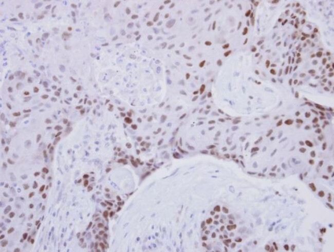 ZNF690 Antibody in Immunohistochemistry (IHC)