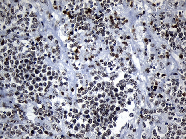 ZNF705D Antibody in Immunohistochemistry (Paraffin) (IHC (P))