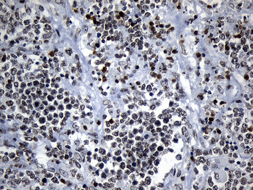 ZNF705D Antibody in Immunohistochemistry (Paraffin) (IHC (P))