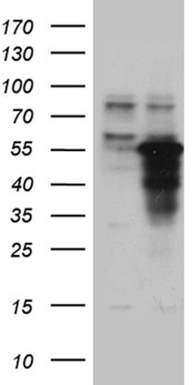 ZNF718 Antibody in Western Blot (WB)