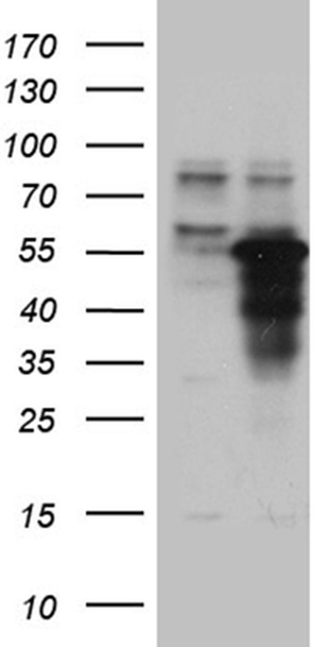 ZNF718 Antibody in Western Blot (WB)