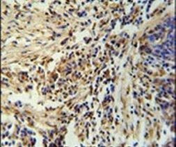 ZNF720 Antibody in Immunohistochemistry (IHC)