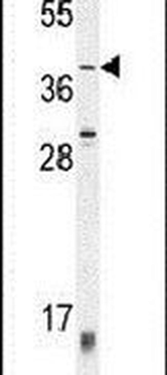 ZNF763 Antibody in Western Blot (WB)