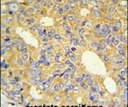 ZNF9 Antibody in Immunohistochemistry (IHC)