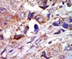 ZPK Antibody in Immunohistochemistry (IHC)