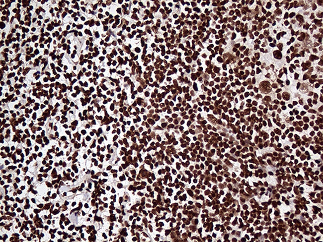 ZRANB2 Antibody in Immunohistochemistry (Paraffin) (IHC (P))