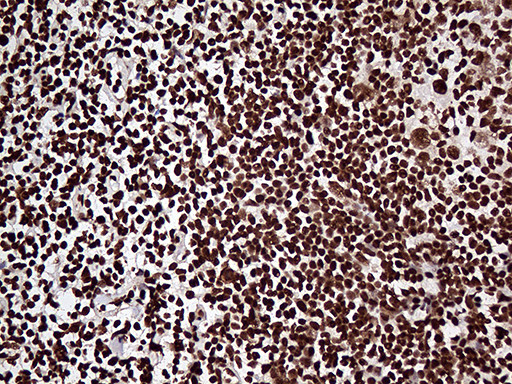 ZRANB2 Antibody in Immunohistochemistry (Paraffin) (IHC (P))