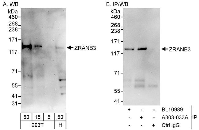 ZRANB3 Antibody in Western Blot (WB)