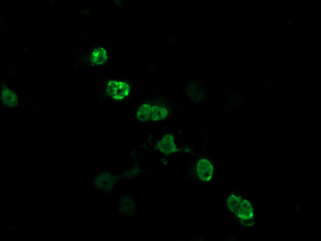 ZSCAN18 Antibody in Immunocytochemistry (ICC/IF)