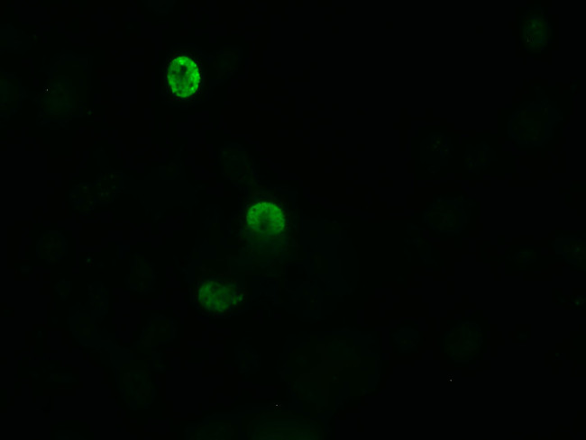 ZSCAN18 Antibody in Immunocytochemistry (ICC/IF)