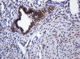 ZSCAN18 Antibody in Immunohistochemistry (Paraffin) (IHC (P))