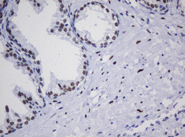 ZSCAN18 Antibody in Immunohistochemistry (Paraffin) (IHC (P))