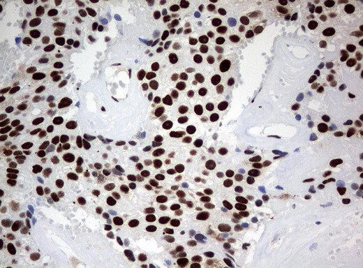 ZSCAN18 Antibody in Immunohistochemistry (Paraffin) (IHC (P))