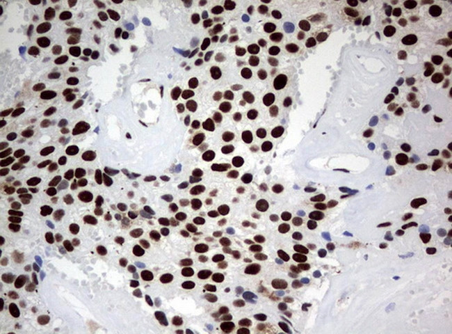 ZSCAN18 Antibody in Immunohistochemistry (Paraffin) (IHC (P))