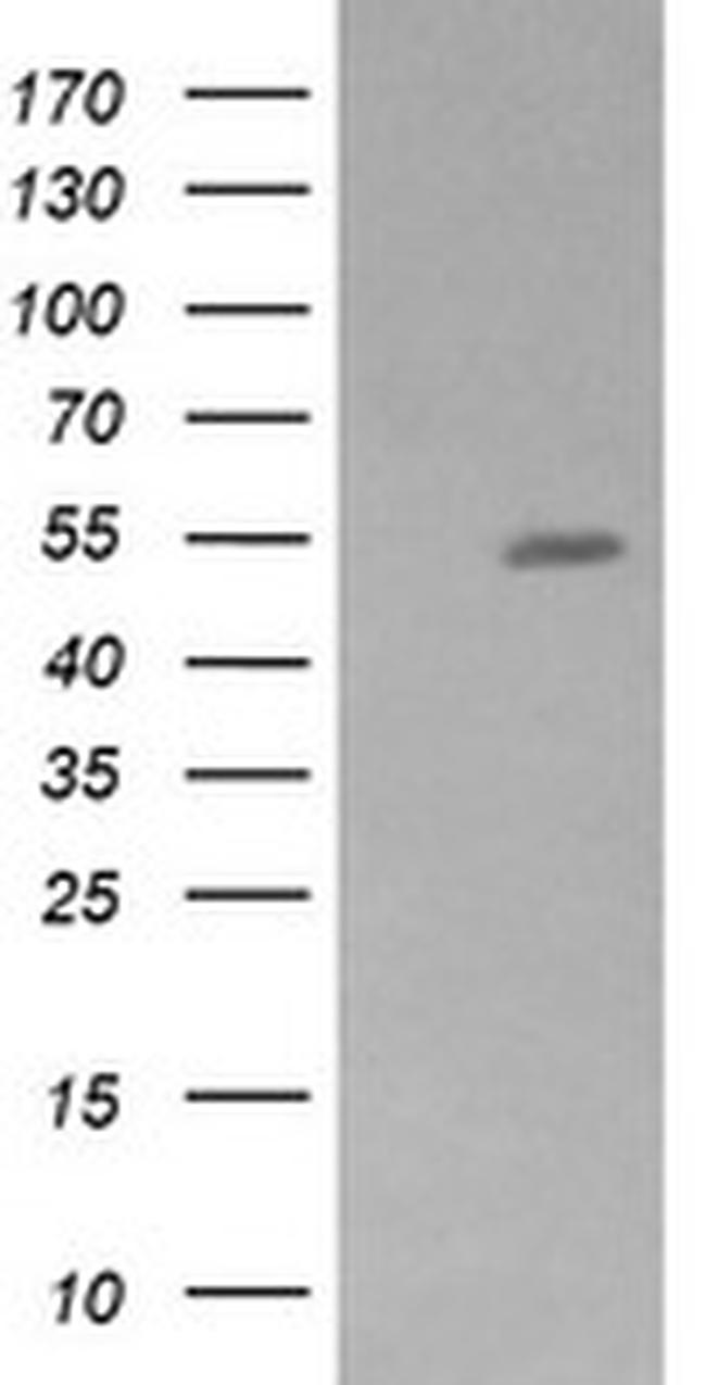 ZSCAN21 Antibody in Western Blot (WB)