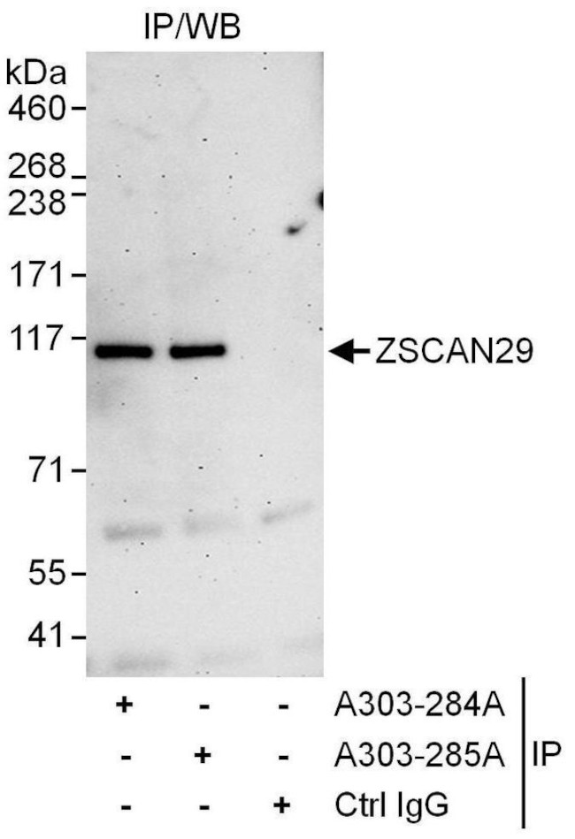 ZSCAN29 Antibody in Immunoprecipitation (IP)