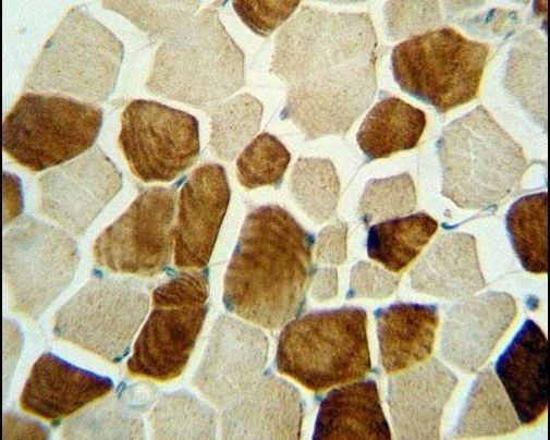 ZSWIM6 Antibody in Immunohistochemistry (IHC)