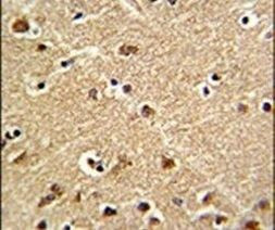 ZWINT Antibody in Immunohistochemistry (IHC)