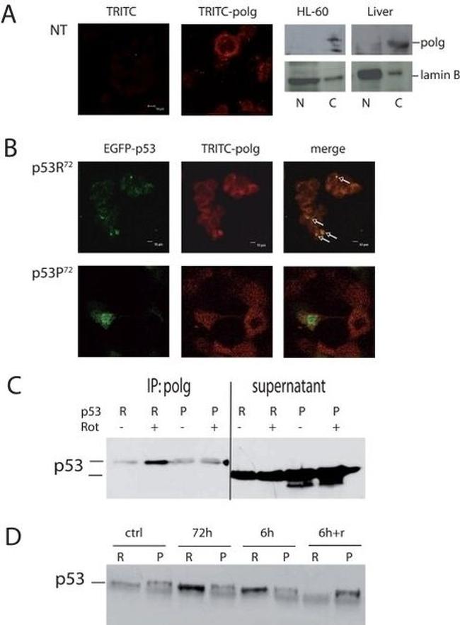 POLG Antibody in Western Blot, Immunoprecipitation (WB, IP)